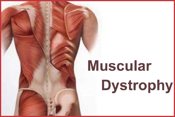 Muscular Pain