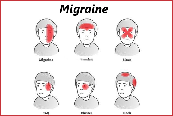 Headache or Migraine